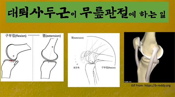 220704 3 무릎 4